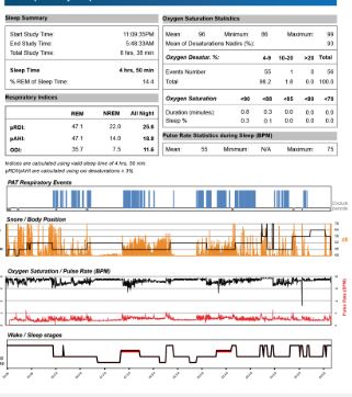 Sleep Report Service for Apex Medical Machines